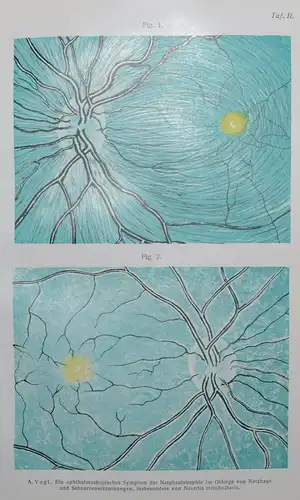 OPHTHALMOLOGIE – BASLER ARBEITEN - AUGENKRANKHEITEN - AUGENHEILKUNDE - 1889-1920