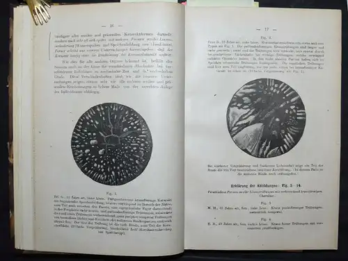 OPHTHALMOLOGIE – BASLER ARBEITEN - AUGENKRANKHEITEN - AUGENHEILKUNDE - 1889-1920