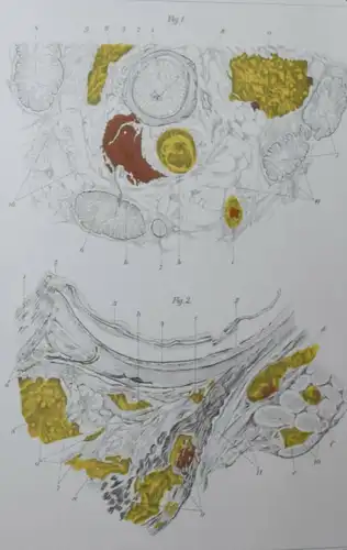 OPHTHALMOLOGIE – BASLER ARBEITEN - AUGENKRANKHEITEN - AUGENHEILKUNDE - 1889-1920