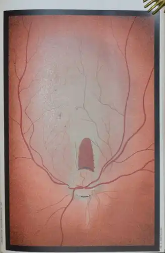 OPHTHALMOLOGIE – BASLER ARBEITEN - AUGENKRANKHEITEN - AUGENHEILKUNDE - 1889-1920