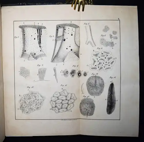 Budd, Die Krankheiten der Leber 1846 - INNERE MEDIZIN GASTROENTEROLOGIE