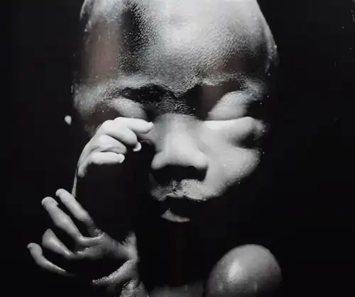 Moriyama, Daido- Pantomime SIGNIERT - JAPAN - FÖTUS - BABY - BABYS