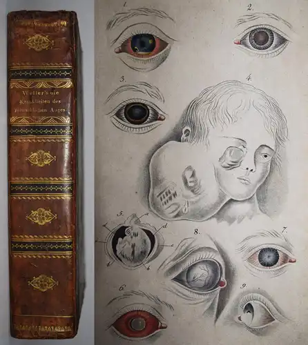 Weller, Die Krankheiten des menschlichen Auges 1826 AUGENHEILKUNDE OPHTHAMOLOGIE