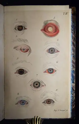 Weller, Die Krankheiten des menschlichen Auges 1826 AUGENHEILKUNDE OPHTHAMOLOGIE