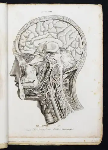 ANATOMIE-ATLAS 1848 - Martin-Lauzer, Atlas...Medico-chirurgicales NEUROLOGIE
