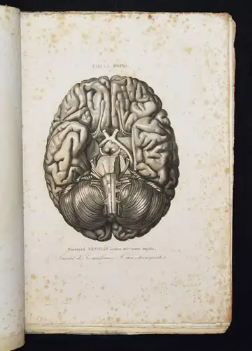 ANATOMIE-ATLAS 1848 - Martin-Lauzer, Atlas...Medico-chirurgicales NEUROLOGIE