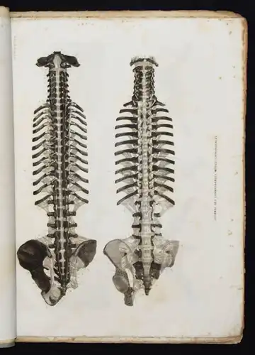 ANATOMIE-ATLAS 1848 - Martin-Lauzer, Atlas...Medico-chirurgicales NEUROLOGIE