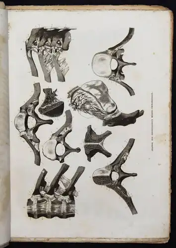 ANATOMIE-ATLAS 1848 - Martin-Lauzer, Atlas...Medico-chirurgicales NEUROLOGIE