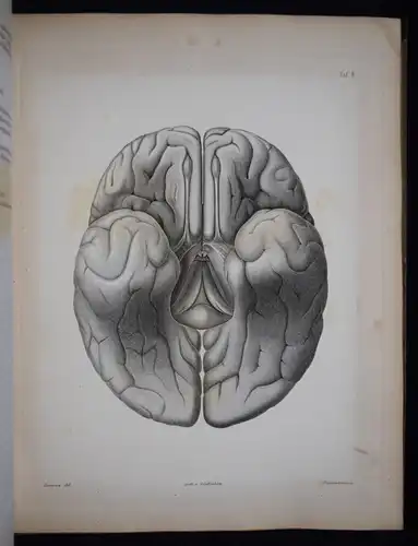 Reichert, Der Bau des menschlichen Gehirns  - 1859 - ANATOMIE