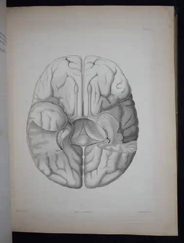 Reichert, Der Bau des menschlichen Gehirns  - 1859 - ANATOMIE