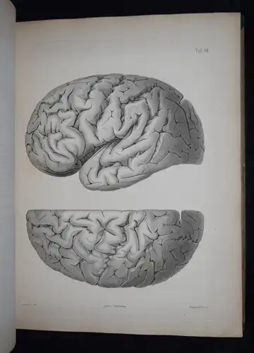 Reichert, Der Bau des menschlichen Gehirns  - 1859 - ANATOMIE