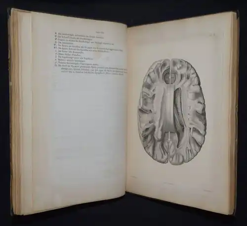 Reichert, Der Bau des menschlichen Gehirns  - 1859 - ANATOMIE