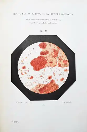 Pasteur, Etudes sur le vin 1873 ÖNOLOGIE WEIN FERMENTATION PASTEURISATION CHEMIE