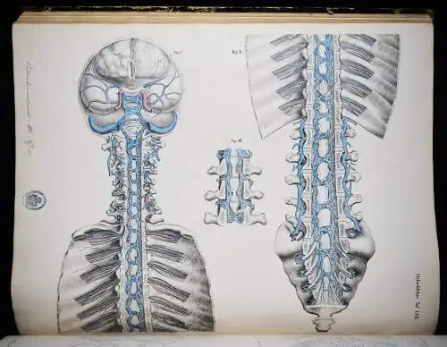 Oesterreicher, Anatomischer Atlas 1852 IMPERIAL-FOLIO ! ANATOMIE ANATOMY