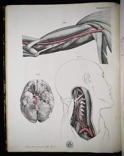 Oesterreicher, Anatomischer Atlas 1852 IMPERIAL-FOLIO ! ANATOMIE ANATOMY