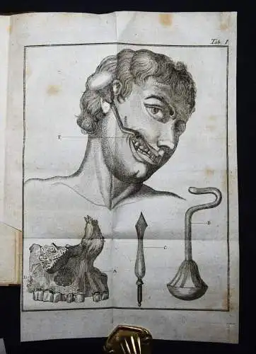Böttcher,...von den Krankheiten der Knochen 1789 KOMPLETT ! ANATOMIE CHIRURGIE