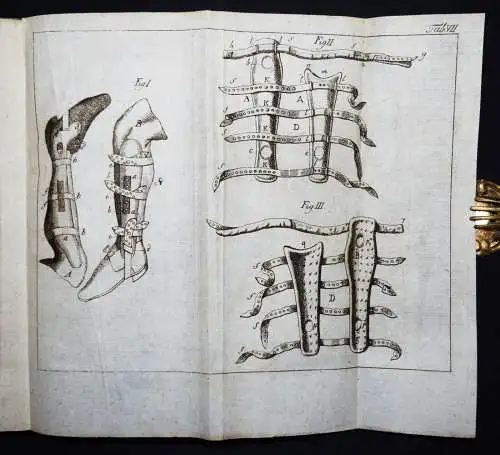 Böttcher,...von den Krankheiten der Knochen 1789 KOMPLETT ! ANATOMIE CHIRURGIE