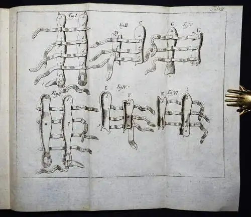 Böttcher,...von den Krankheiten der Knochen 1789 KOMPLETT ! ANATOMIE CHIRURGIE