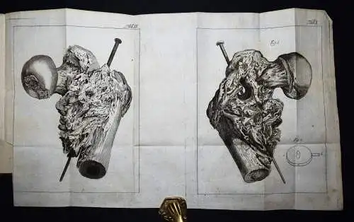 Böttcher,...von den Krankheiten der Knochen 1789 KOMPLETT ! ANATOMIE CHIRURGIE