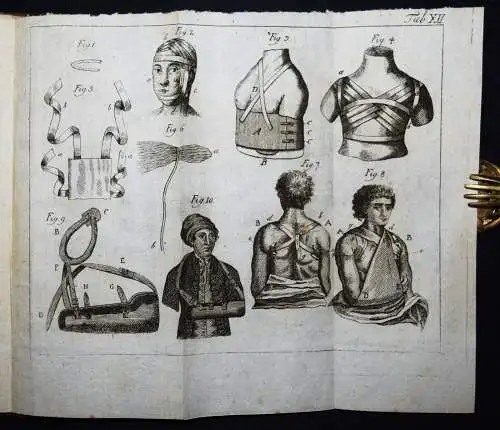 Böttcher,...von den Krankheiten der Knochen 1789 KOMPLETT ! ANATOMIE CHIRURGIE