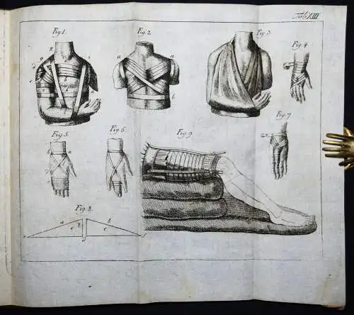 Böttcher,...von den Krankheiten der Knochen 1789 KOMPLETT ! ANATOMIE CHIRURGIE