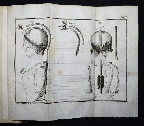 Böttcher,...von den Krankheiten der Knochen 1789 KOMPLETT ! ANATOMIE CHIRURGIE