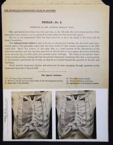 STEREOPHOTOGRAPHIE Waterston, The Edinburgh Stereoscopic Atlas of Anatomy THORAX