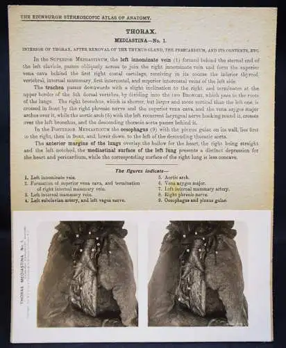 STEREOPHOTOGRAPHIE Waterston, The Edinburgh Stereoscopic Atlas of Anatomy THORAX