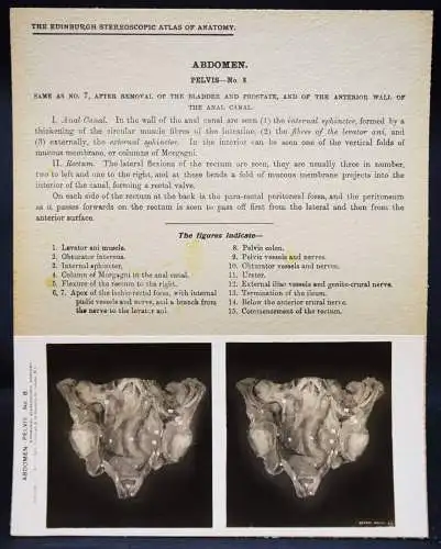 STEREOPHOTOGRAPHIE Waterston, The Edinburgh Stereoscopic Atlas of Anatomy THORAX