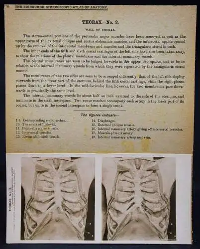 STEREOPHOTOGRAPHIE Waterston, The Edinburgh Stereoscopic Atlas of Anatomy THORAX