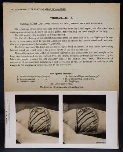 STEREOPHOTOGRAPHIE Waterston, The Edinburgh Stereoscopic Atlas of Anatomy THORAX