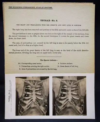 STEREOPHOTOGRAPHIE Waterston, The Edinburgh Stereoscopic Atlas of Anatomy THORAX