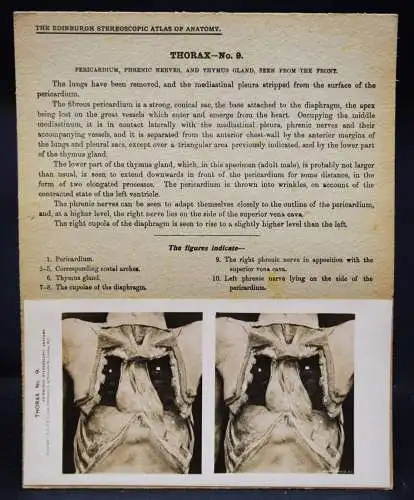 STEREOPHOTOGRAPHIE Waterston, The Edinburgh Stereoscopic Atlas of Anatomy THORAX