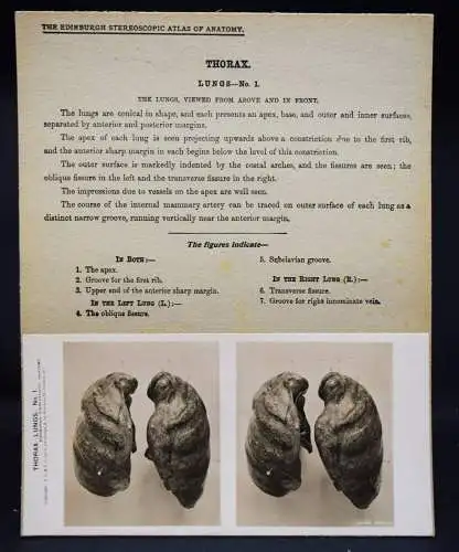 STEREOPHOTOGRAPHIE Waterston, The Edinburgh Stereoscopic Atlas of Anatomy THORAX