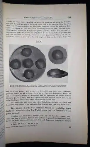 Dallos, Haftgläser und Kontaktschalen 1933 KONTAKTLINSEN OPTIK AUGENHEILKUNDE