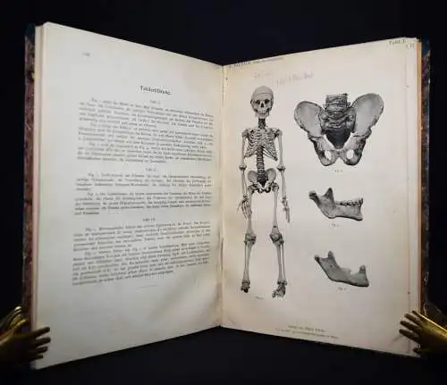 Paltauf, Über den Zwergwuchs in anatomischer und... 1891 KLEINWÜCHSIGKEIT