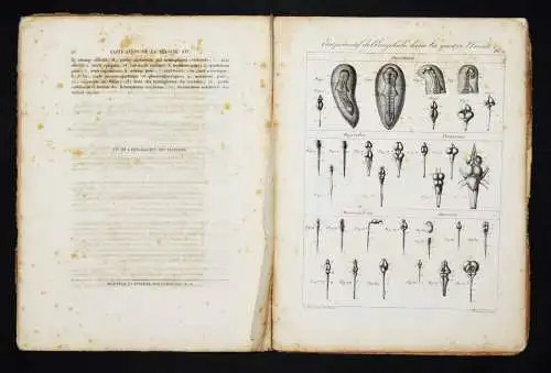 Serre, Anatomie comparee du cerveau - 1824 GEHRIN ANATOMIE NEUROCHIRURGIE