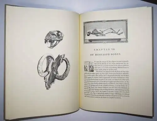 Cheselden, William. Osteographia 1890 IMPERIAL-FOLIO FAKSIMILE NUMMERIERT 1/2300