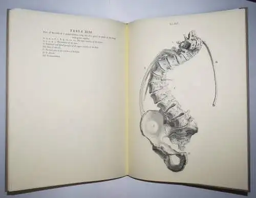Cheselden, William. Osteographia 1890 IMPERIAL-FOLIO FAKSIMILE NUMMERIERT 1/2300
