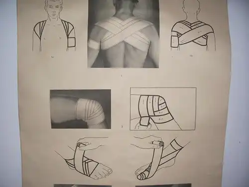 Rollkarte Lehrkarte  Bindenverbände II  Hygiene Museum Dresden deko vintage 
