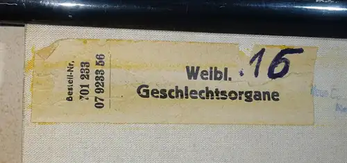 Vintage Rollkarte Weibliche Geschlechtsorgane Lehrkarte Wandtafel DDR deko (20