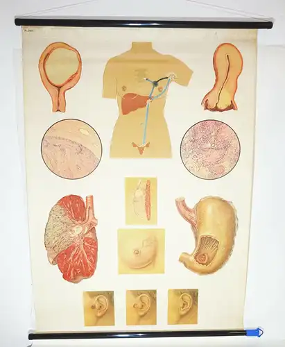 Vintage Rollkarte Krebs Erkrankung Medizin DDR Lehrkarte Wandtafel (8
