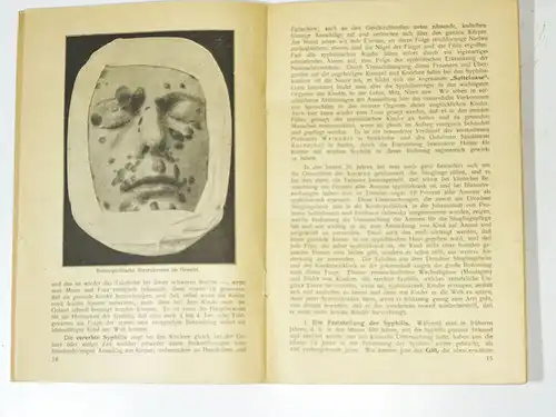 Geschlechtskrankheiten und ihre Bekämpfung 1919 Austellung Chemnitz