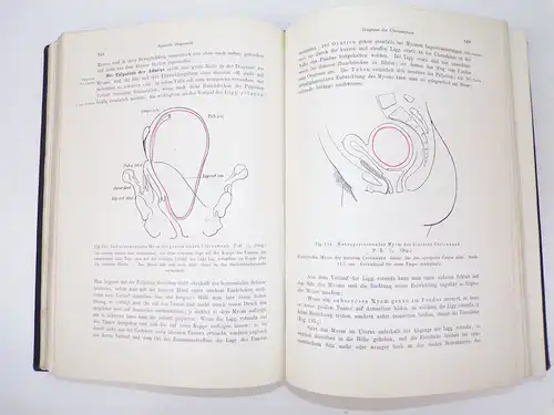 Lehrbuch der gynäkologischen Diagnostik 1907 Winter Frauenheilkunde Buch