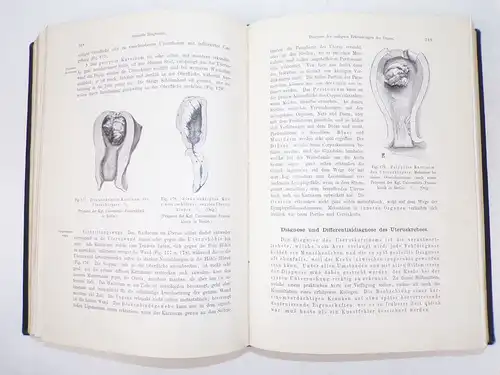 Lehrbuch der gynäkologischen Diagnostik 1907 Winter Frauenheilkunde Buch