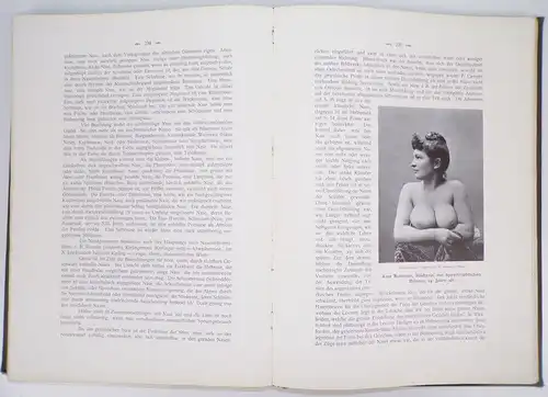 Krauss 2 Bücher Die Anmut des Frauenleibes Die Frauen im Schönheitsspiegel 