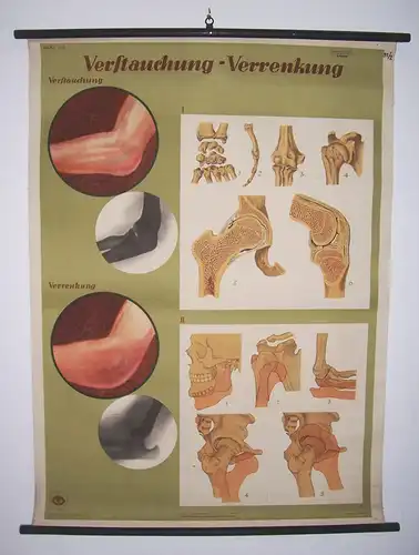 Rollkarte Lehrkarte Verstauchung Verrenkung M R signiert Hygiene Museum 