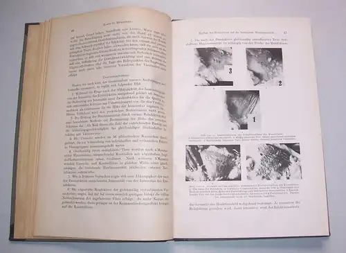 Einfluß der Reinfektion bestehende Hautimmunität 1948 Münsterer Dermatologie !