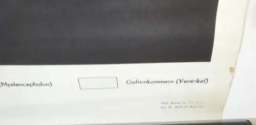 Vintage Rollkarte Entwicklung Gehirn Karfen Wasserfrosch Biologie deko (33