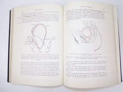 Lehrbuch der gynäkologischen Diagnostik 1907 Winter Frauenheilkunde Buch